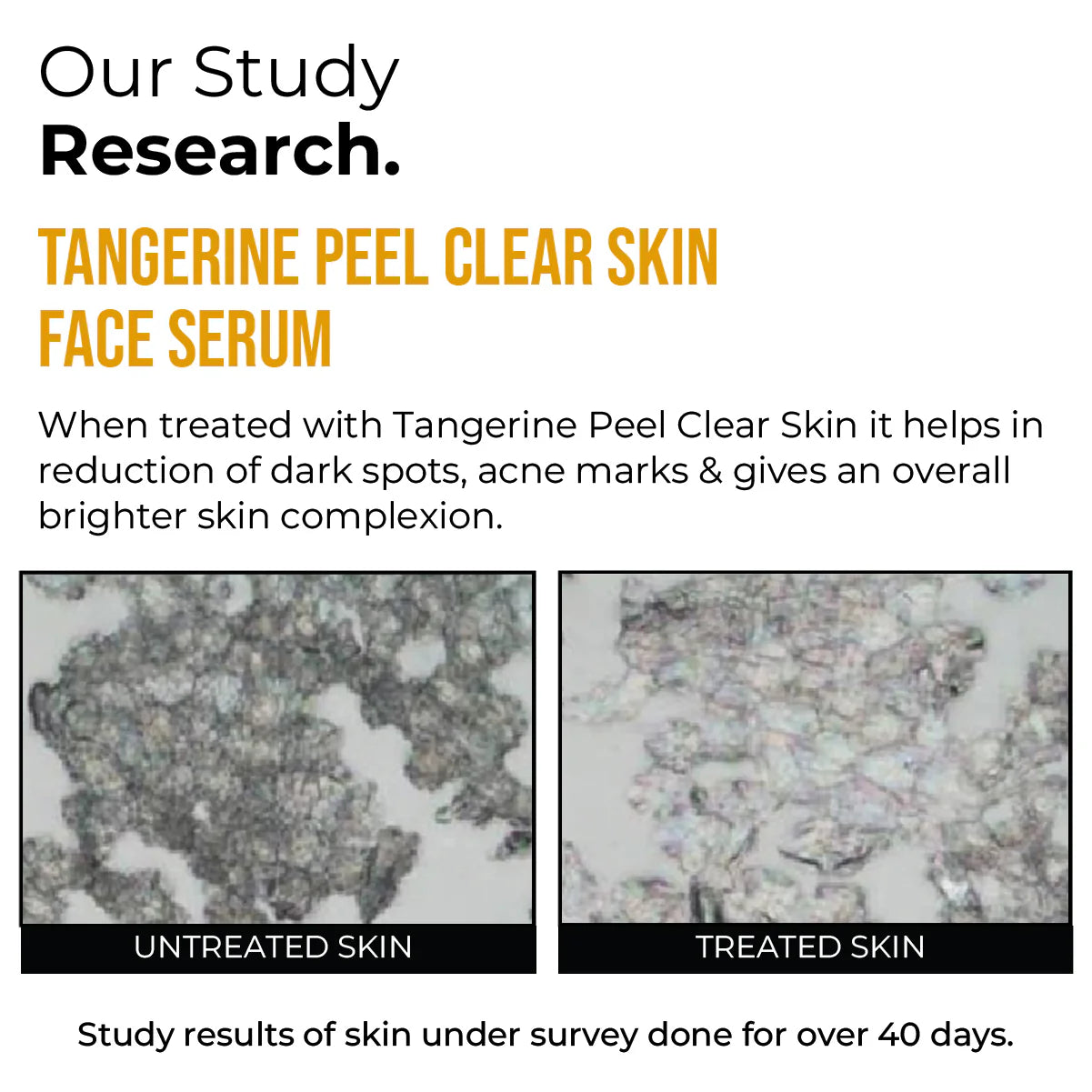 nsight Cosmetics Tangerine Peel Clear Skin Face Serum (30ml)