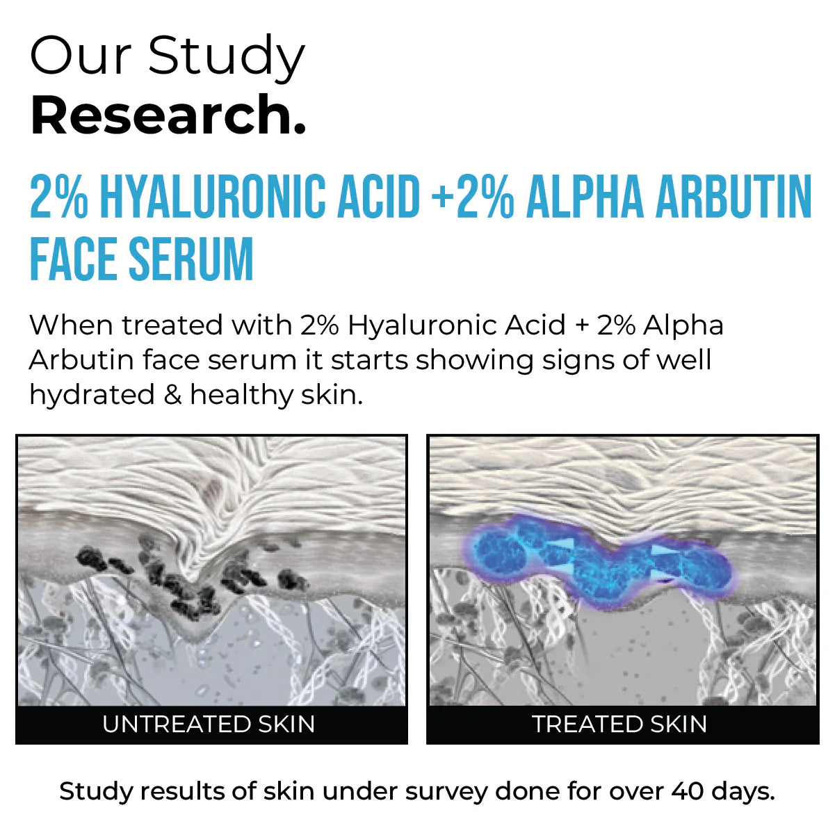 Insight Professiona 2% Hyaluronic Acid + 2% Alpha Arbutin Face Serum