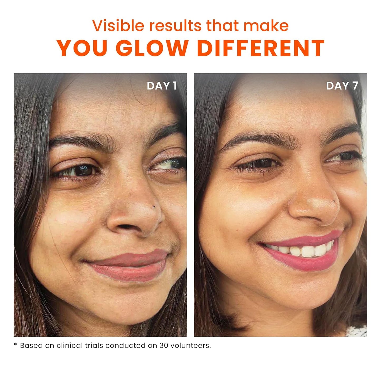 Foxtale Overnight Glow Mask | 4% Glycolic Acid | 3% Lactic Acid |Reduces Blackheads, Whiteheads | 30 Second Salon like Brightening Facial for Glowing Skin | Men & Women - 30ml Visit the FoxTale Store