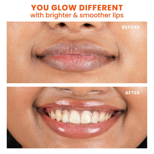 Foxtale SPF 30 Brightening Lip Balm for Dark Lips with Peptides & Vitamin C | Brightens | Hydrates | Tinted Lip Balm| 12gm