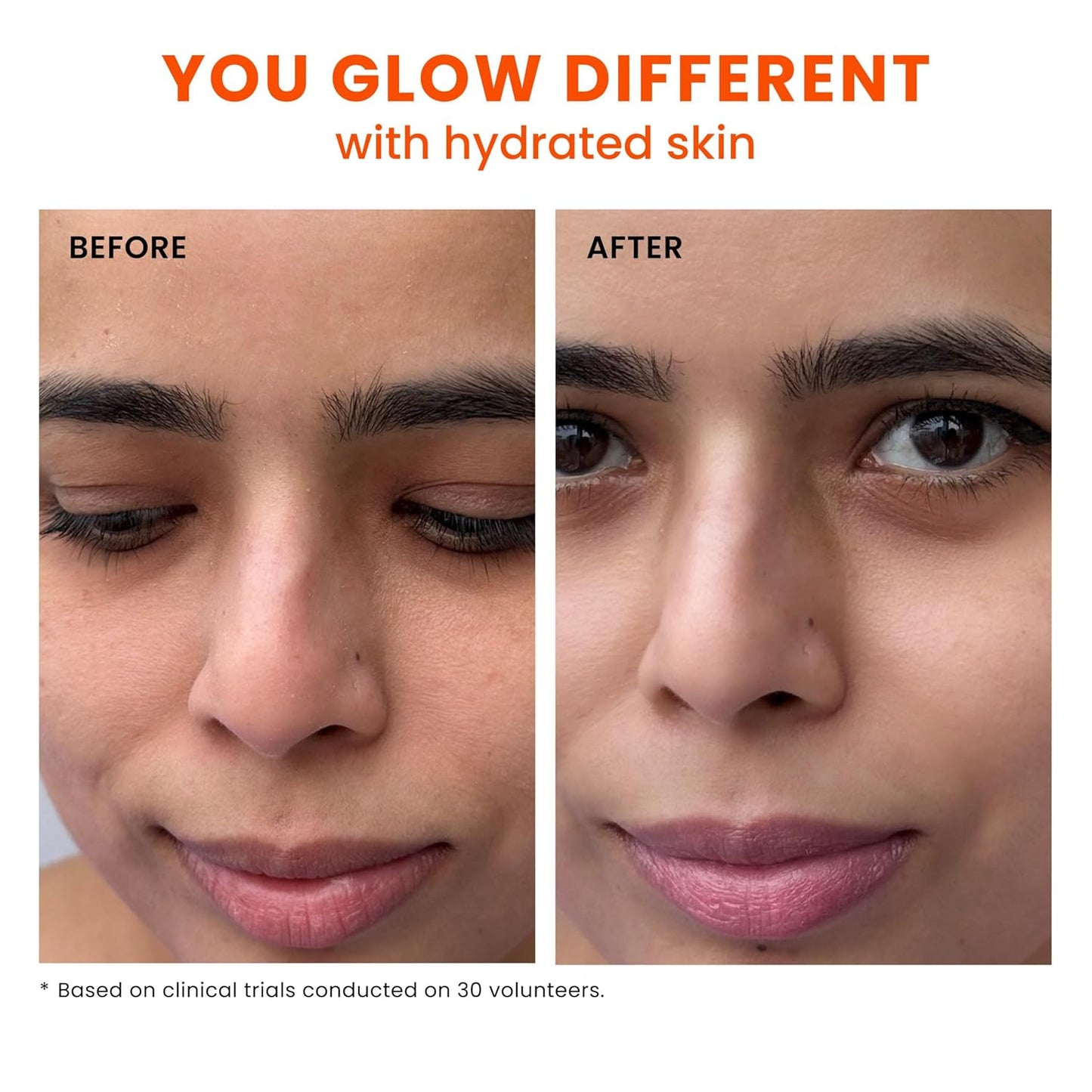 Foxtale Nourishing Ceramide Moisturizer