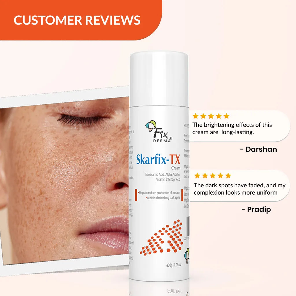 Skarfix-TX Cream | Effective treatment for melasma and dark spots 15g