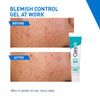 CeraVe Blemish Control Gel with 2% Salicylic Acid, AHA & Niacinamide for Acne Spot Treatment (40ml)