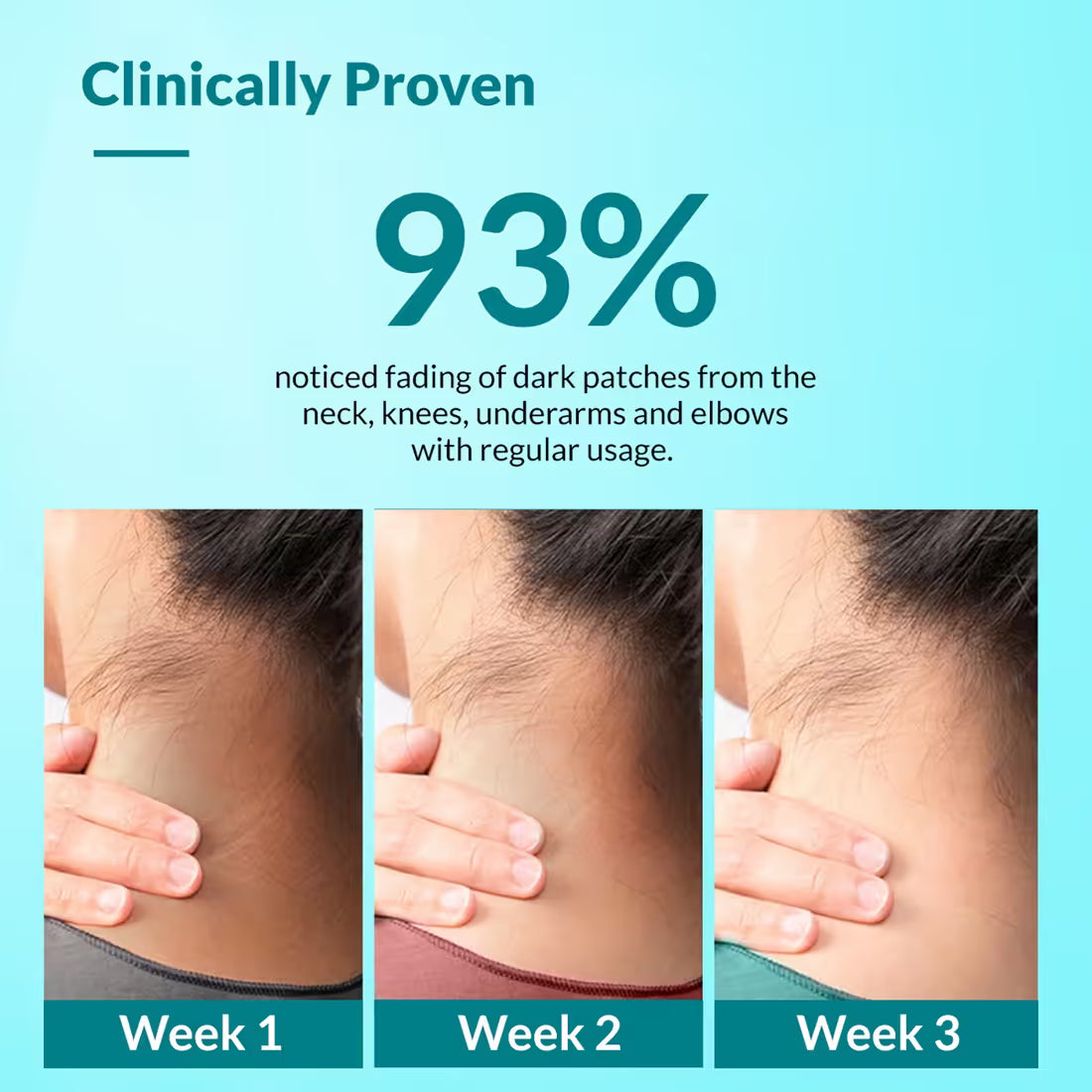 Fix derma Nigrifix Cream