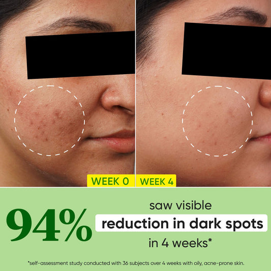 Dot & Key Spot Reduction Face Serum