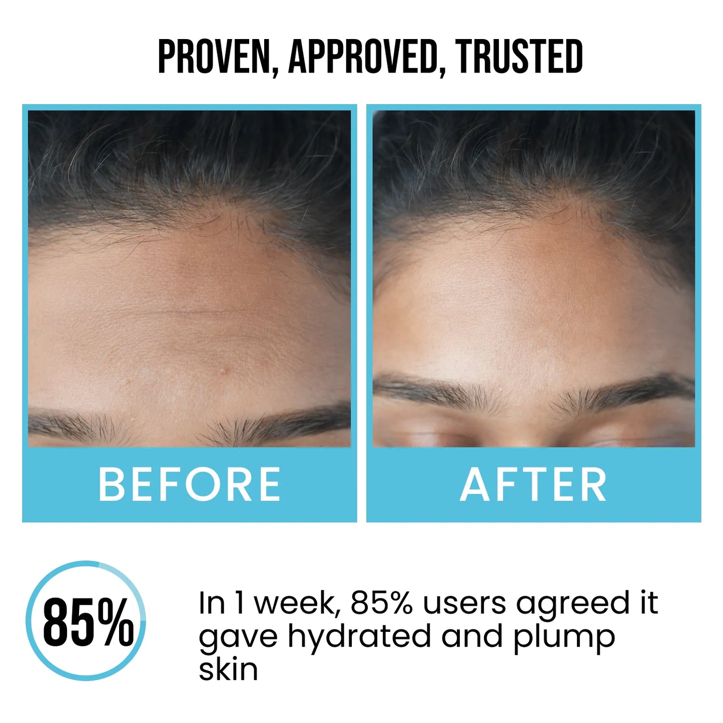 Insight Professiona 2% Hyaluronic Acid + 2% Alpha Arbutin Face Serum