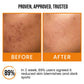 NSIGHT 18% Vitamin C Brightening Face Serum | Dull Skin Revival | Texture Repair | Pigmentation Reduction | All Skin Types | 30 ml
