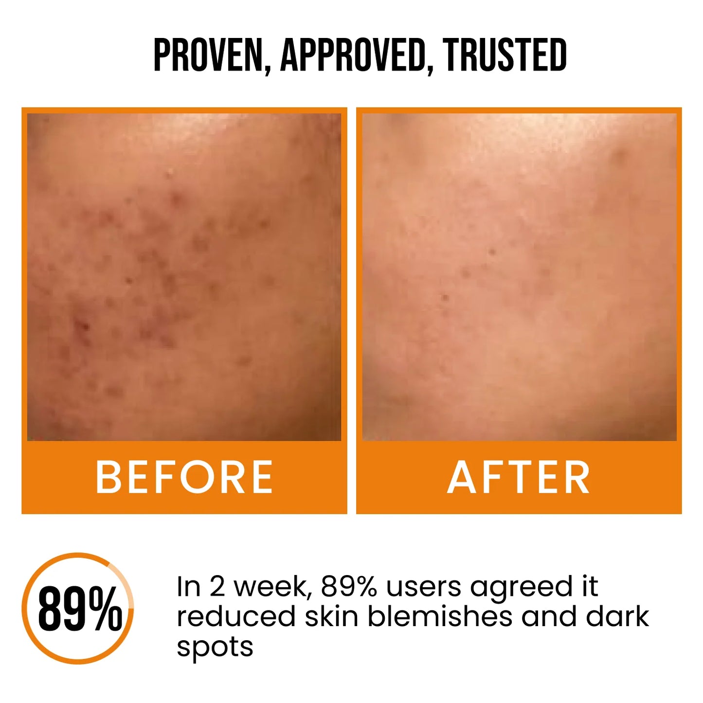 NSIGHT 18% Vitamin C Brightening Face Serum | Dull Skin Revival | Texture Repair | Pigmentation Reduction | All Skin Types | 30 ml