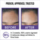 Insight 0.5% Retinol Anti-Ageing Face Serum (30ml)