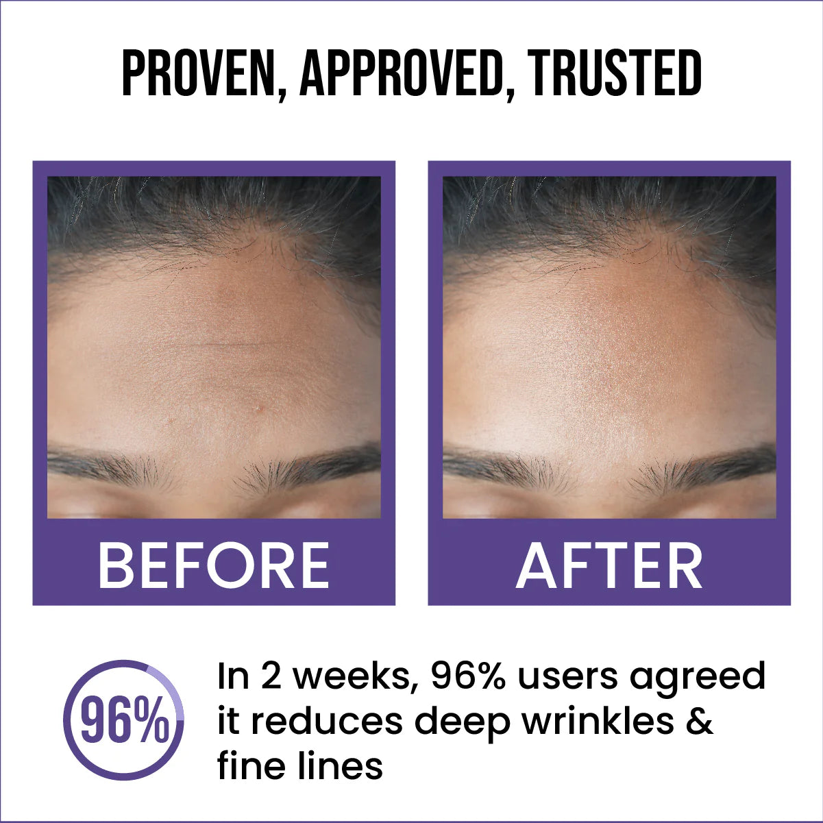 Insight 0.5% Retinol Anti-Ageing Face Serum (30ml)