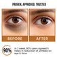 Dark Circle & Spot Reduction Face Serum