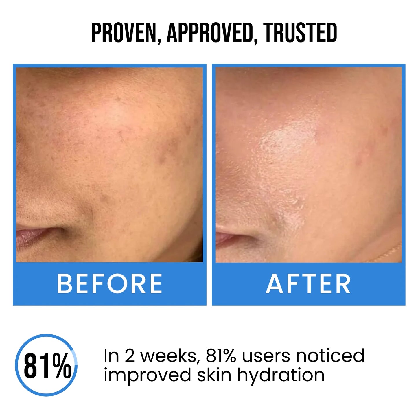 Insight Ultra Hydrating Face Serum (30ml)