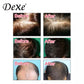 Dexe Anti-hair Loss Lotion 100ml