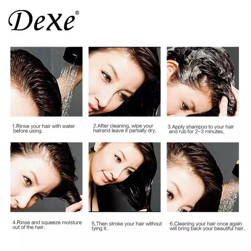 Dexe Anti-hair Loss Lotion 100ml