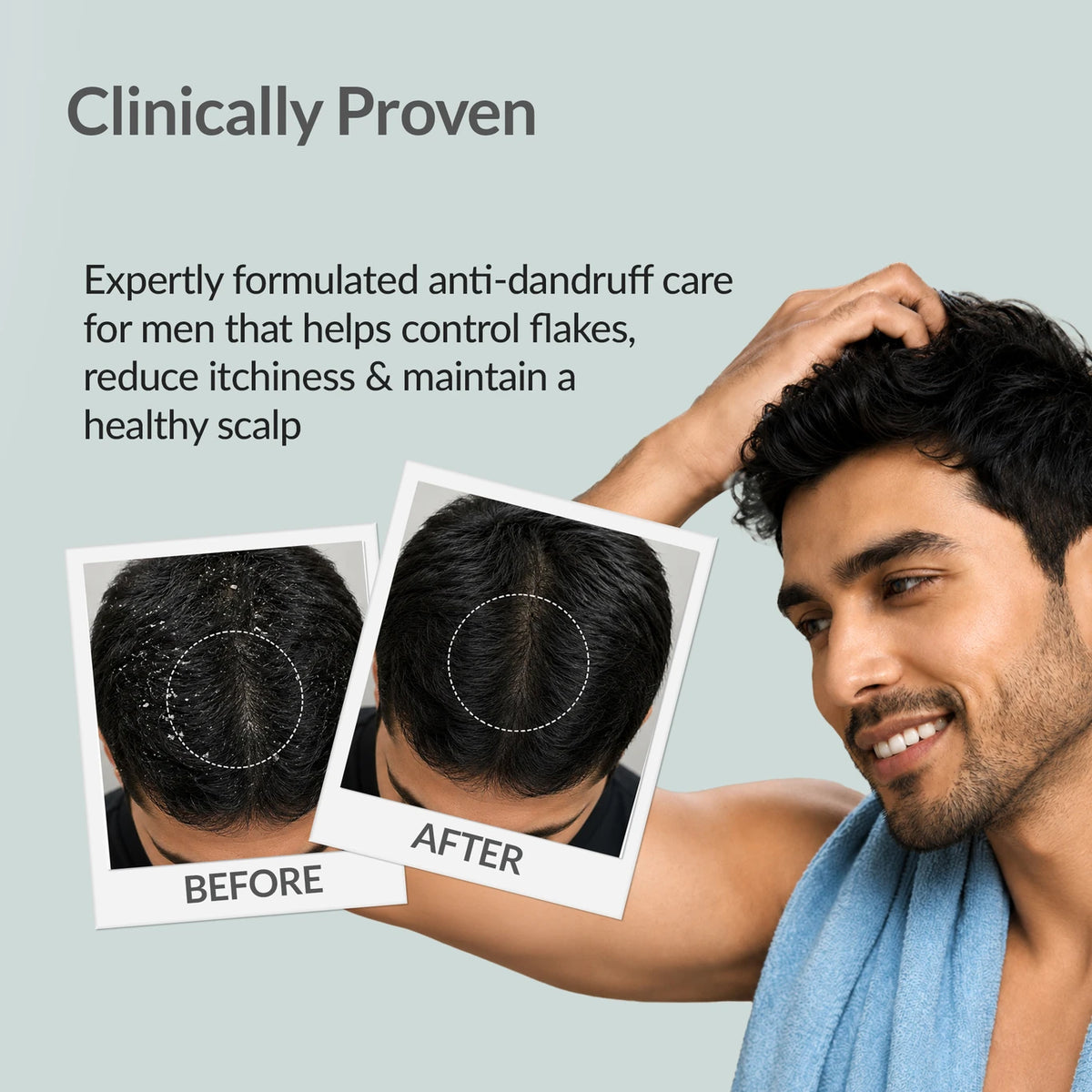 Fixderma For Men Anti-Dandruff Shampoo