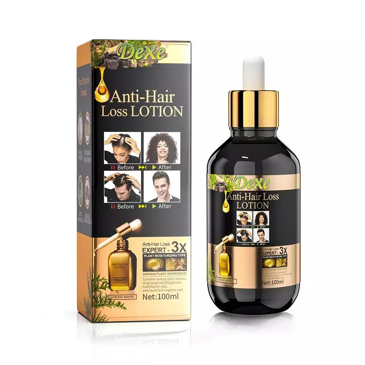 Dexe Anti-hair Loss Lotion 100ml