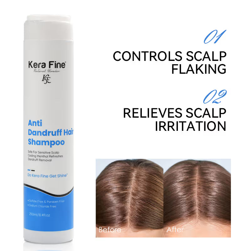 KERA FINE ANTI DANDRUFF HAIR SHAMPOO