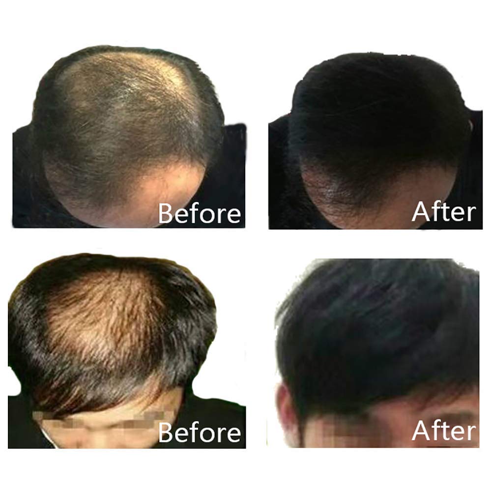 Dexe Hair Building Thickening Fibers For Man