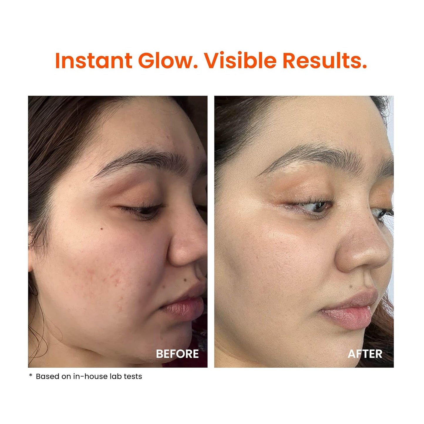 Foxtale Super Glow Moisturizer with Vitamin C | 50ml