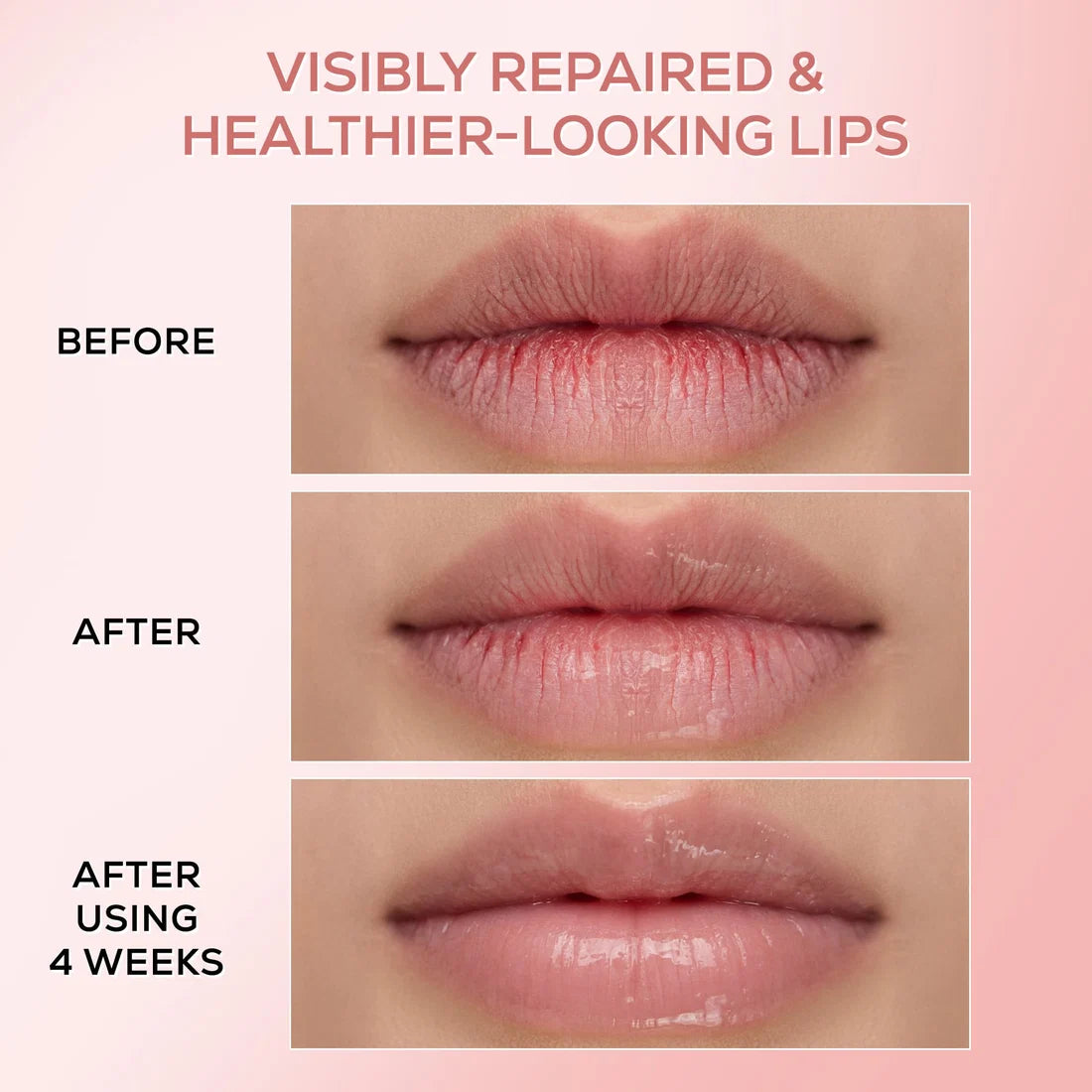 RENEE Pink Therapy PDRN Lip Balm