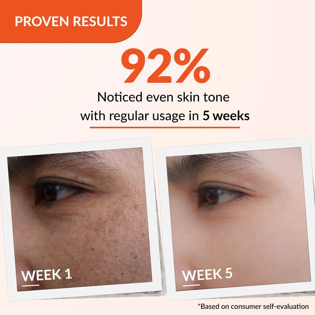 Skarfix-TX Cream | Effective treatment for melasma and dark spots 15g