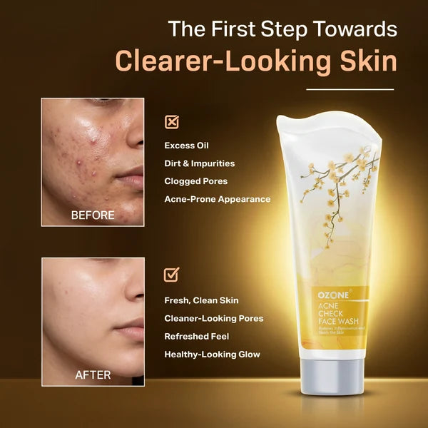 Acne Check Face Wash