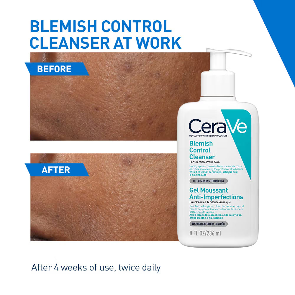 CeraVe Blemish Control Cleanser with 2% Salicylic Acid & Niacinamide for Acne-prone skin (236ml)