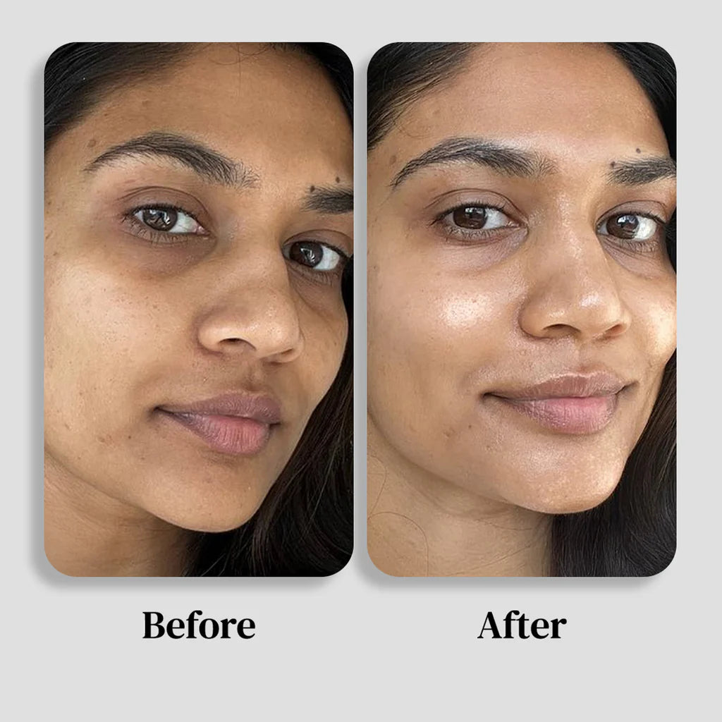 Mitchell USA AGE-LESS Intense Dark Spot Remover - Fading Serum: Dark Spot Removal Serum 50ml