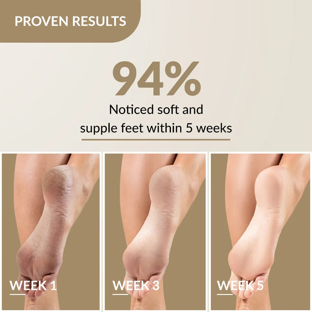 Fix Derma  Foobetik Foot Cream | With Natural Emollients to Treat All Foot-Related Problems