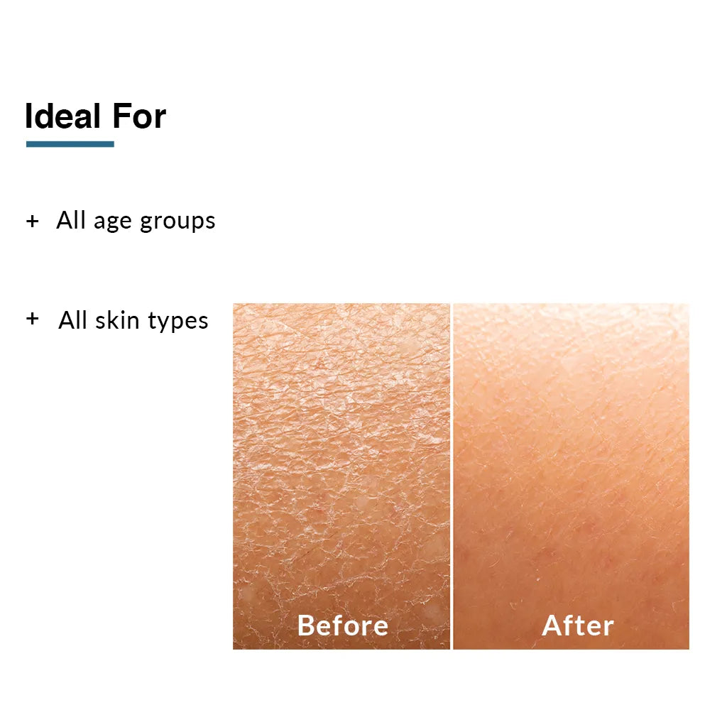 Fix Derma Moisturizing Lotion | Perfect Solution To Provide Optimal Hydration For Dry Skin