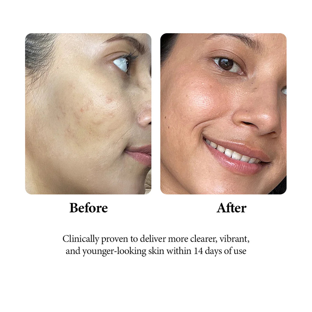 Mitchell USA AGE-LESS Papaya Brightening Cleanser - Natural Anti-aging Face Wash (200ml)