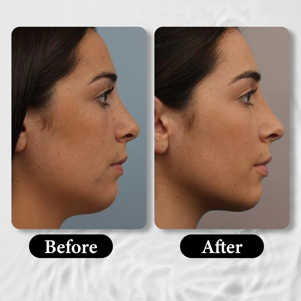 Mitchell USA AGE-LESS Anti-aging Face Sculpting Mask - Face Mask for Sagging Skin 50gm