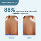 Fix Derma Salyzap Body Wash | Soap-Free Wash to Combat Stubborn Body Acne