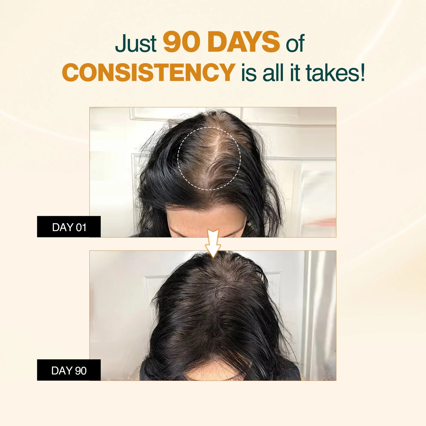 Nourish Mantra Advanced Hair Growth Serum for Hair Regrowth and Prevention of Hair Thinning (50ml)